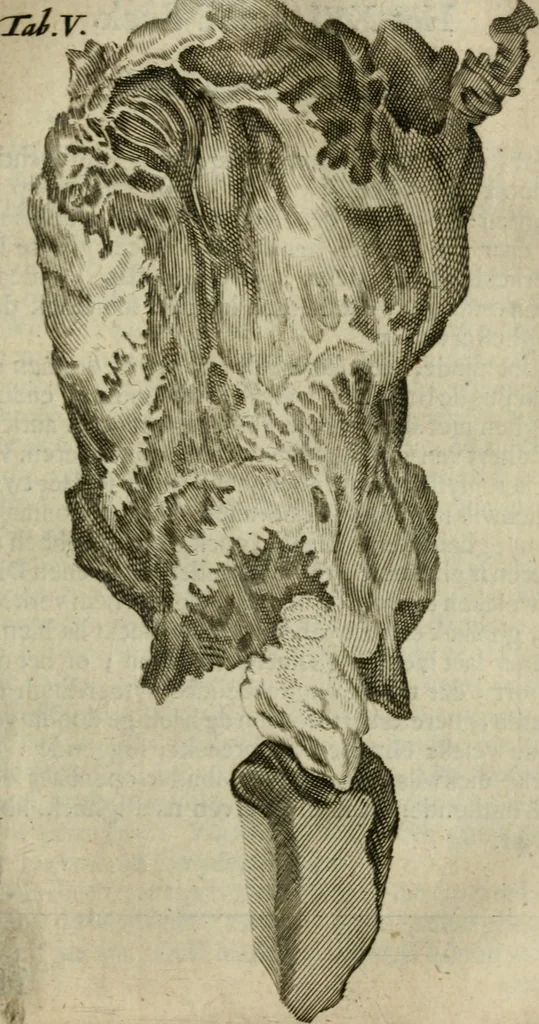 An illustration from De drie boecken der medicijnsche aenmerkingen : in 't Latijn beschreven, 1650, leaf 146