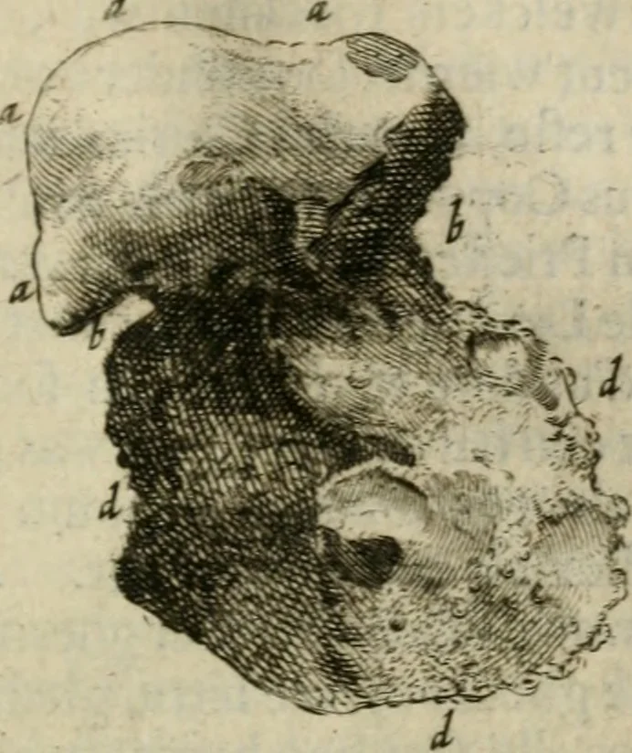 An illustration from De drie boecken der medicijnsche aenmerkingen : in 't Latijn beschreven, 1650, leaf 160