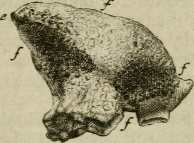An illustration from De drie boecken der medicijnsche aenmerkingen : in 't Latijn beschreven, 1650, leaf 160