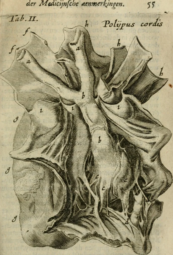 An illustration from De drie boecken der medicijnsche aenmerkingen : in 't Latijn beschreven, 1650, leaf 78