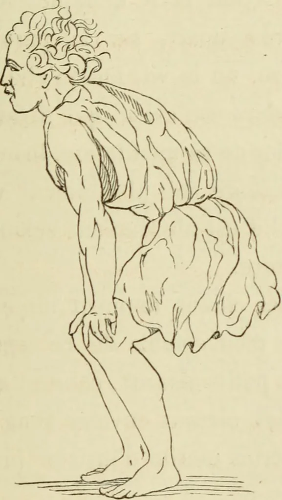 An illustration from De la physionomie et des mouvements d'expression suivie d'une notice sur sa vie et ses travaux et de la nomenclature de ses ouvrages, 1865, leaf 237