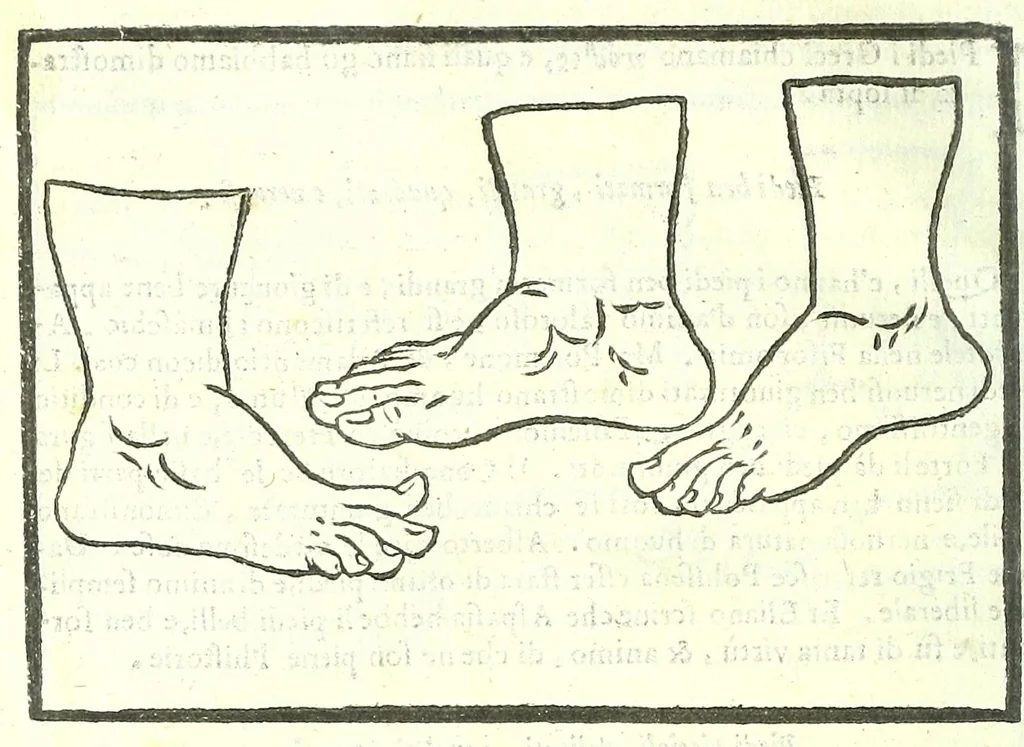 An illustration from Della fisonomia dell'huomo, 1613, leaf 262