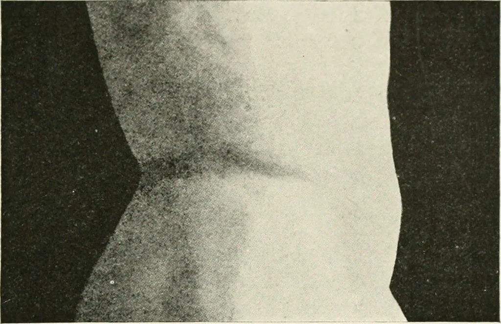 An illustration from Delphi, 1920, leaf 304