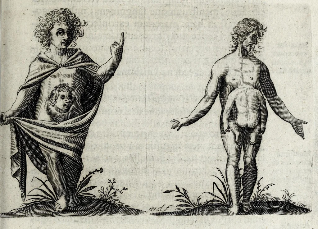 An illustration from De monstrorum caussis, natura, et differentiis libri duo : in quibus ex rei natura monstrorum historiae, caussae, generationes, & differentiae plurimae a sapientibus intactae : cum generatim & in plantarum, & belluarum genere, tum seorsum in humana specie tractantur : multis illustrium autorum locis difficillimis explanatis de masculo parturiente, de feminis in viros mutatis, de hermaphroditorum natura, de dissimilium specierum : venere prolifica, de castratorum fecunditate, depuero lapidescente, de anomantis aurea parte, alijsque admirabilibus, 1634, leaf 131