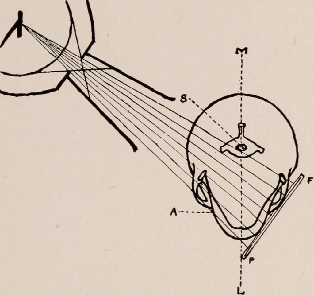 An illustration from Dental and oral radiography : a text book for students and practitioners of dentistry, 1916, leaf 102