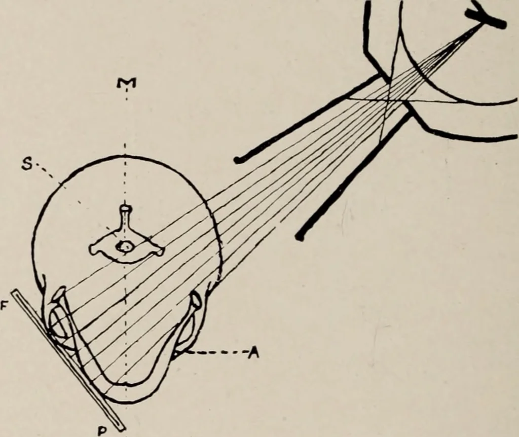 An illustration from Dental and oral radiography : a text book for students and practitioners of dentistry, 1916, leaf 103
