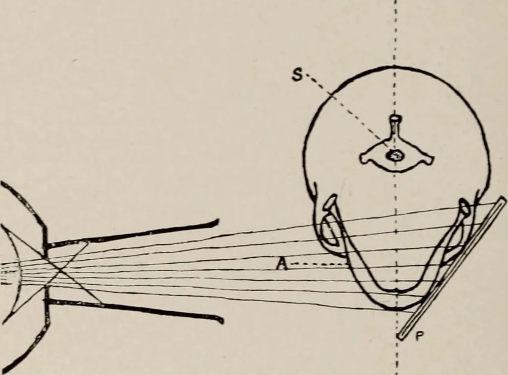 An illustration from Dental and oral radiography : a text book for students and practitioners of dentistry, 1916, leaf 105