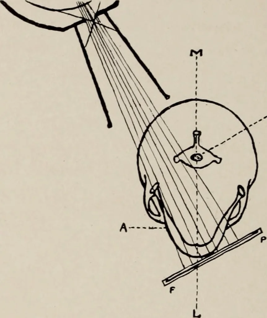 An illustration from Dental and oral radiography : a text book for students and practitioners of dentistry, 1916, leaf 107
