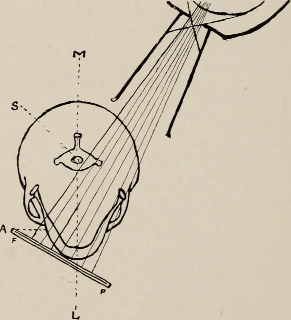 An illustration from Dental and oral radiography : a text book for students and practitioners of dentistry, 1916, leaf 107