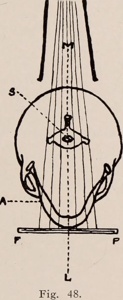 An illustration from Dental and oral radiography : a text book for students and practitioners of dentistry, 1916, leaf 108