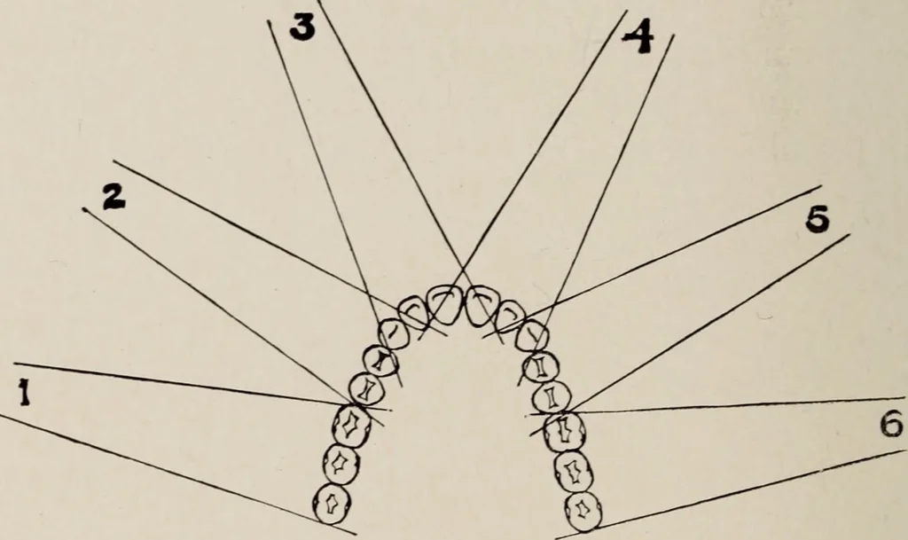 An illustration from Dental and oral radiography : a text book for students and practitioners of dentistry, 1916, leaf 95