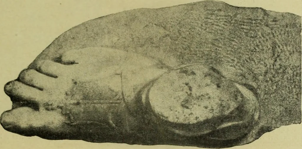 An illustration from Der schoene Mensch im Altertum; eine Geschichte des Koerperideals bei Aegyptern, Orientalen u. Griechen, 1912, leaf 133