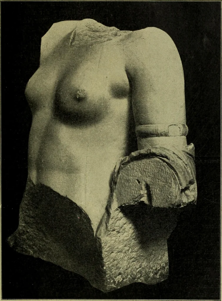 An illustration from Der schoene Mensch im Altertum; eine Geschichte des Koerperideals bei Aegyptern, Orientalen u. Griechen, 1912, leaf 197