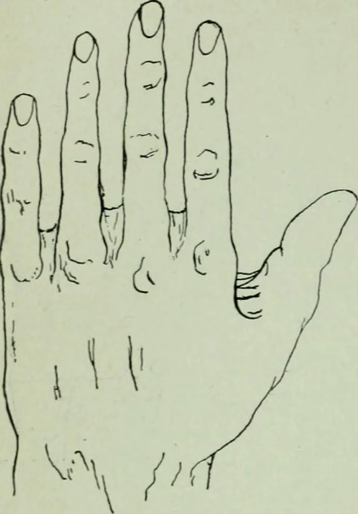 An illustration from Descriptive mentality from the head, face and hand, 1899, leaf 138