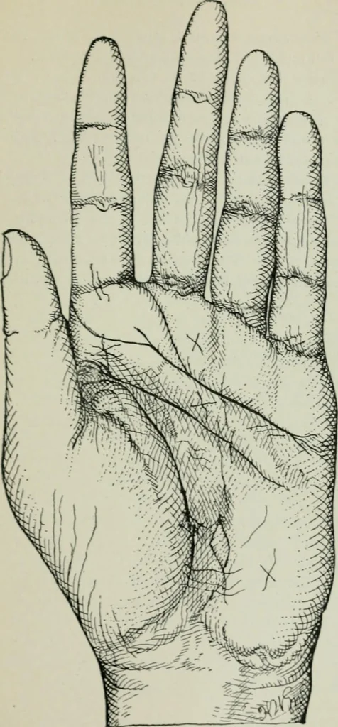 An illustration from Descriptive mentality from the head, face and hand, 1899, leaf 155