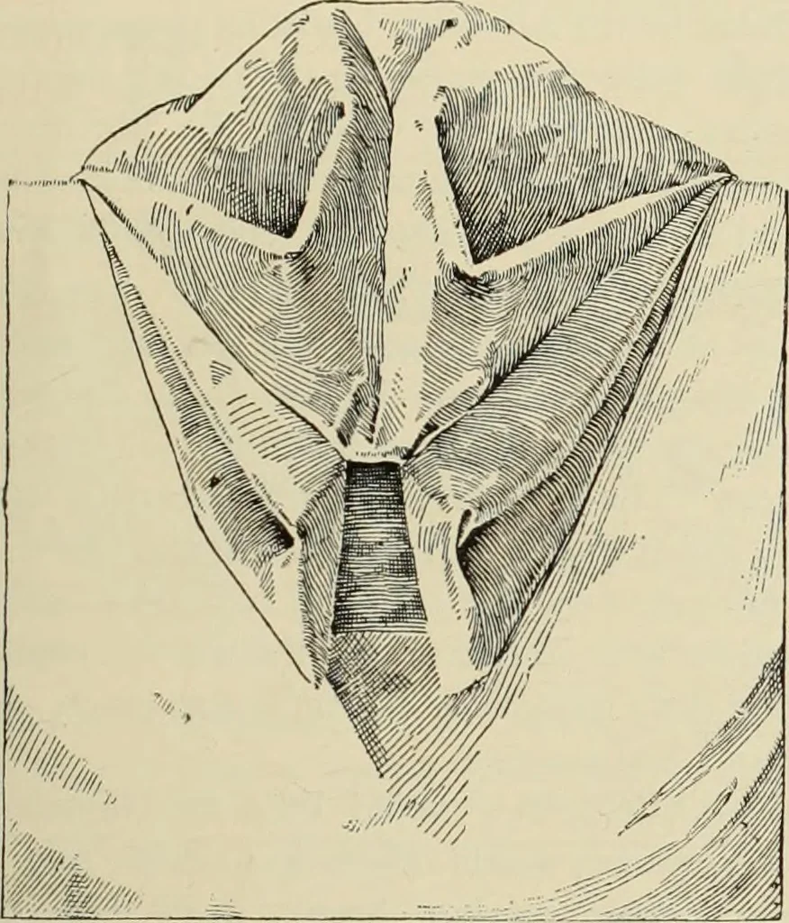 An illustration from Style (1893), 1893, leaf 158