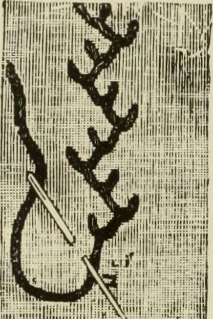 An illustration from The dictionary of needlework : an encyclopaedia of artistic, plain, and fancy needlework dealing fully with the details of all the stitches employed, the method of working, the materials used, the meaning of technical terms, and, where necessary, tracing the origin and history of the various works described, 1882, leaf 106