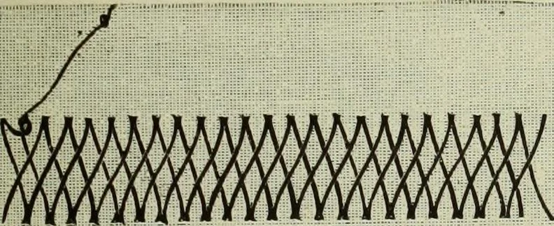 An illustration from The dictionary of needlework : an encyclopaedia of artistic, plain, and fancy needlework dealing fully with the details of all the stitches employed, the method of working, the materials used, the meaning of technical terms, and, where necessary, tracing the origin and history of the various works described, 1882, leaf 117