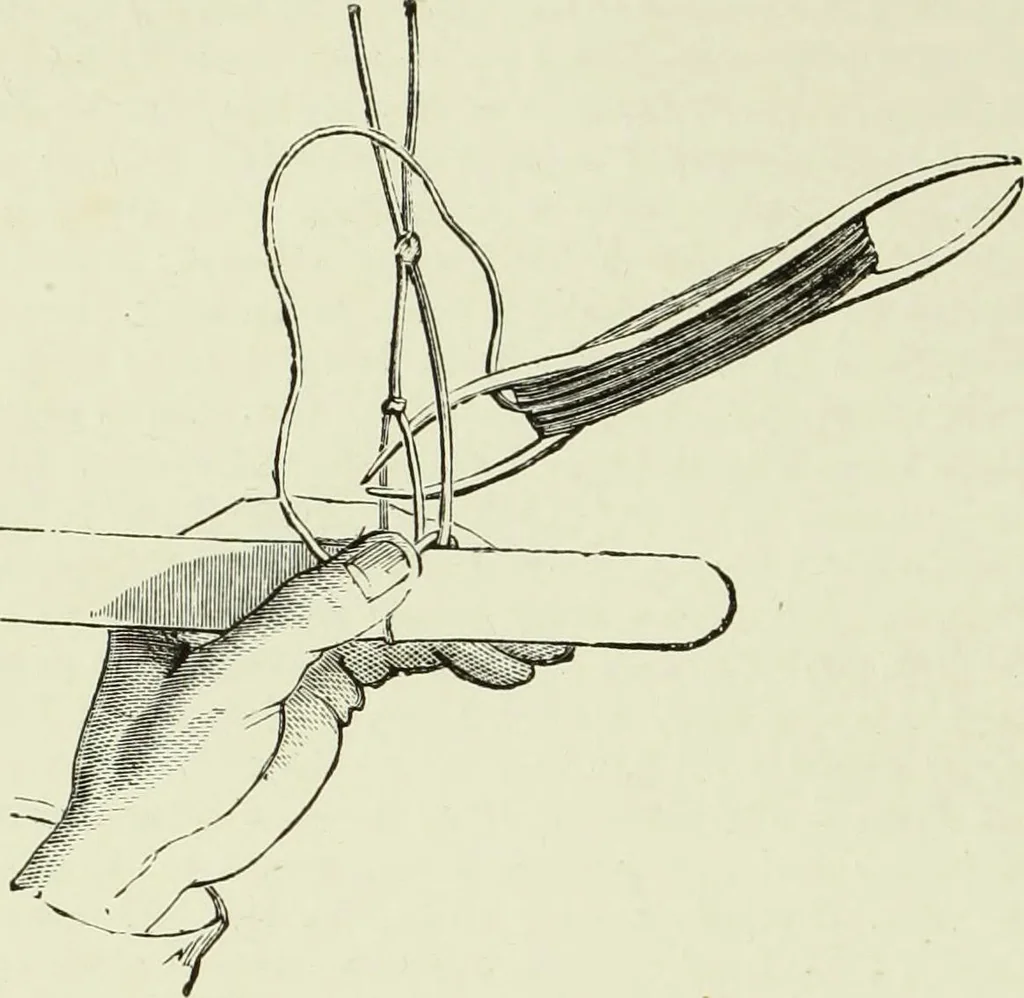 An illustration from The dictionary of needlework : an encyclopaedia of artistic, plain, and fancy needlework dealing fully with the details of all the stitches employed, the method of working, the materials used, the meaning of technical terms, and, where necessary, tracing the origin and history of the various works described, 1882, leaf 89