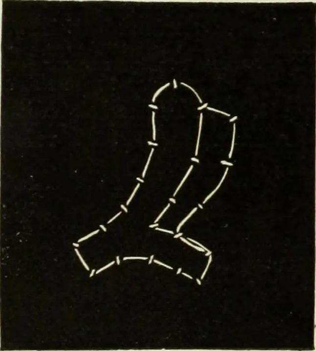 An illustration from The dictionary of needlework : an encyclopaedia of artistic, plain, and fancy needlework dealing fully with the details of all the stitches employed, the method of working, the materials used, the meaning of technical terms, and, where necessary, tracing the origin and history of the various works described, 1882, leaf 89