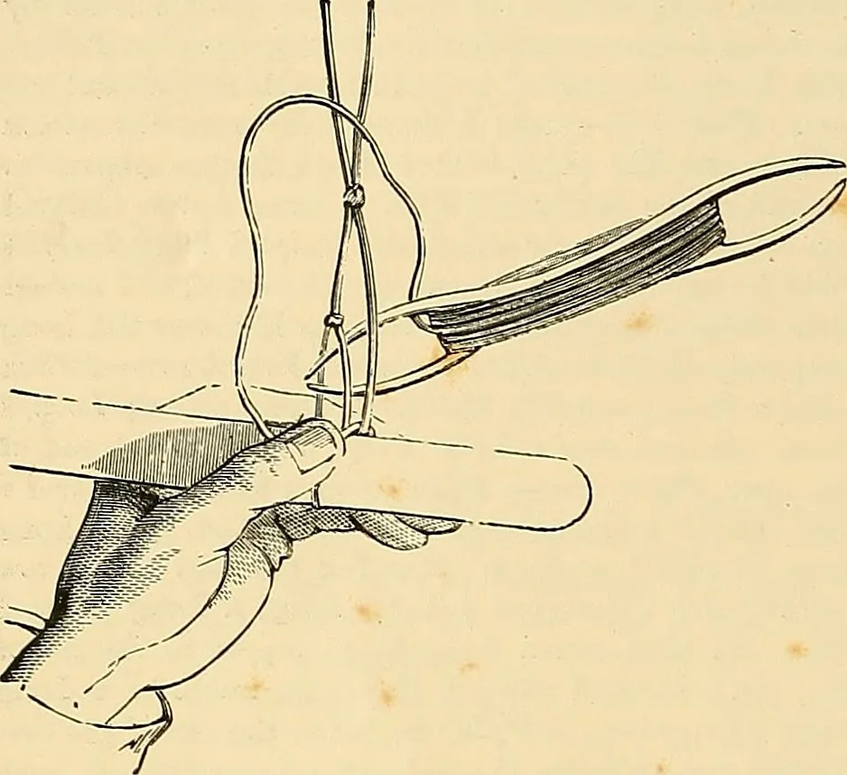 An illustration from The dictionary of needlework : an encyclopædia of artistic, plain, and fancy needlework ..., 1882, leaf 77
