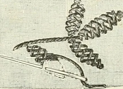 An illustration from The dictionary of needlework : an encyclopædia of artistic, plain, and fancy needlework ..., 1882, leaf 200