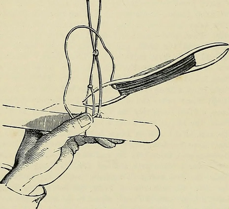 An illustration from The dictionary of needlework : an encyclopædia of artistic, plain, and fancy needlework ..., 1882, leaf 371