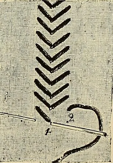 An illustration from The dictionary of needlework : an encyclopaedia of artistic, plain, and fancy needlework. Dealing fully with the details of all the stitches employed, the method of working, the materials used, the meaning of technical terms, and, where necessary, tracing the origin and history of the various works described. Illustrated with upwards of 800 wood engravings, and coloured plates. Plain sewing, textiles, dressmaking, appliances, and terms, 1885, leaf 119