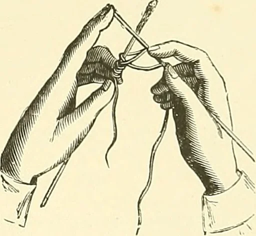 An illustration from The dictionary of needlework : an encyclopaedia of artistic, plain, and fancy needlework. Dealing fully with the details of all the stitches employed, the method of working, the materials used, the meaning of technical terms, and, where necessary, tracing the origin and history of the various works described. Illustrated with upwards of 800 wood engravings, and coloured plates. Plain sewing, textiles, dressmaking, appliances, and terms, 1885, leaf 110