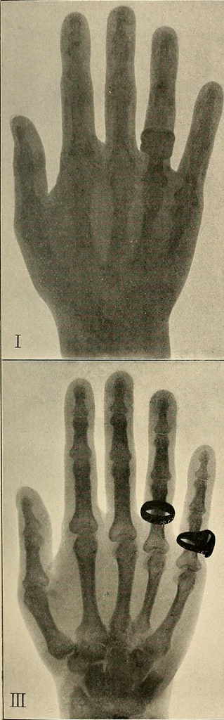 An illustration from Die Einrichtungen zur Erzeugung der Roentgenstrahlen, 1903, leaf 118