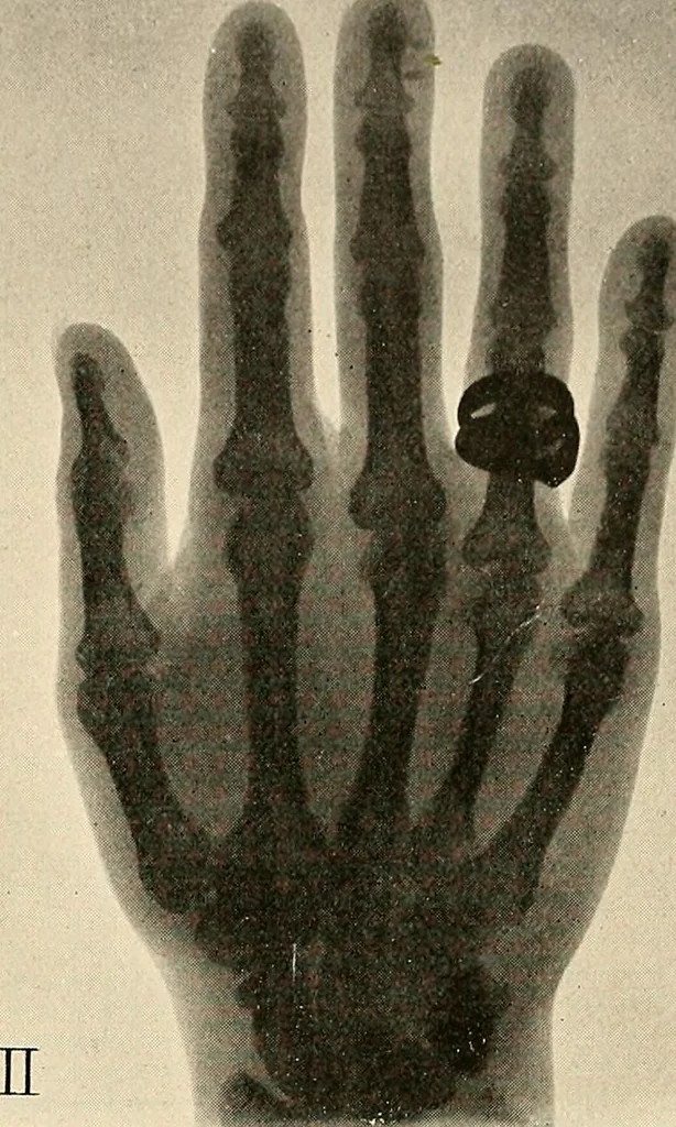 An illustration from Die Einrichtungen zur Erzeugung der Roentgenstrahlen, 1903, leaf 118