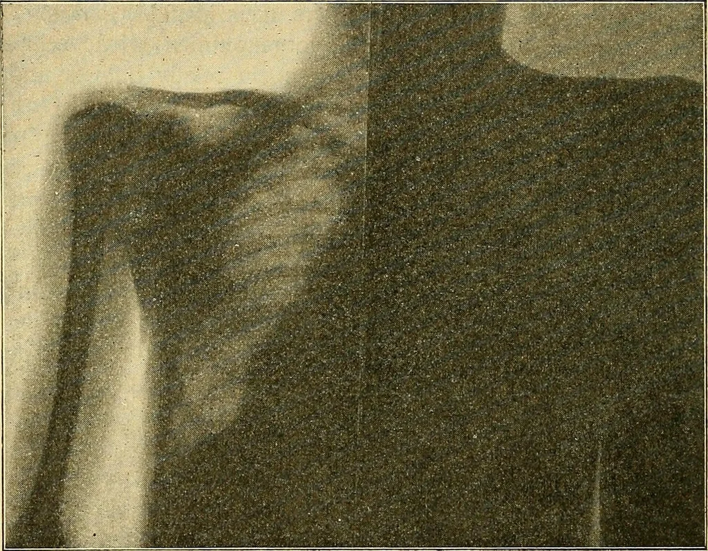 An illustration from Die Einrichtungen zur Erzeugung der Roentgenstrahlen, 1903, leaf 207