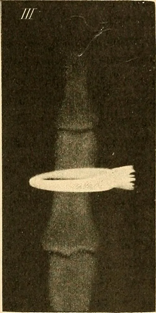 An illustration from Die Einrichtungen zur Erzeugung der Roentgenstrahlen, 1903, leaf 212
