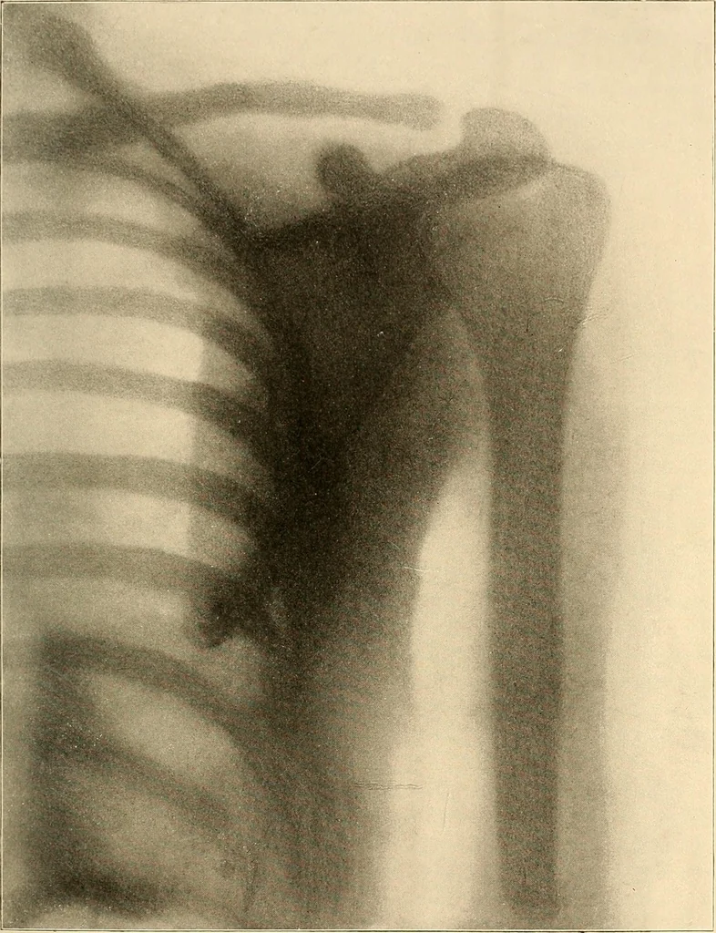 An illustration from Die Einrichtungen zur Erzeugung der Roentgenstrahlen und ihr Gebrauch : gemeinfasslich dargestellt insbesondere auch für Ärzte und Kliniken, 1899, leaf 153