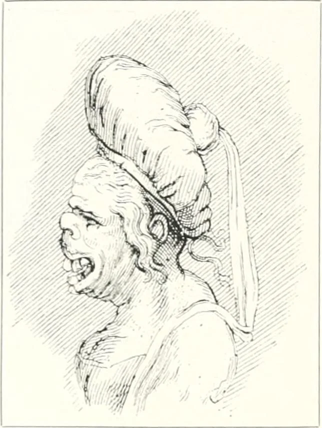 An illustration from Die Karikatur und Satire in der Medizin : mediko-kunsthistorische Studie, 1921, leaf 173