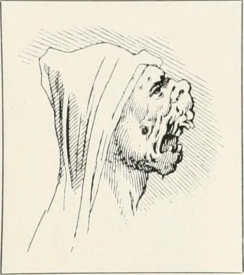 An illustration from Die Karikatur und Satire in der Medizin : mediko-kunsthistorische Studie, 1921, leaf 174