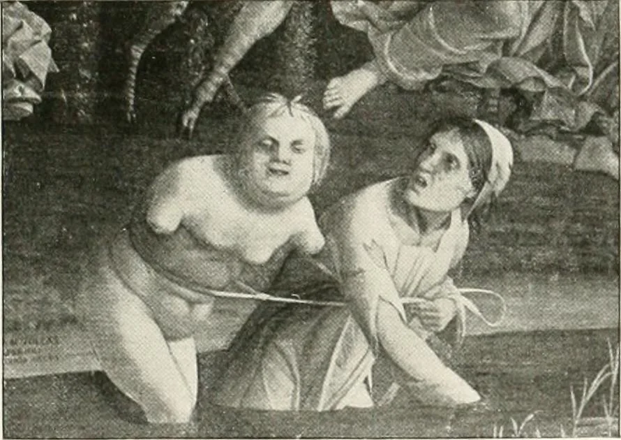 An illustration from Die Karikatur und Satire in der Medizin : mediko-kunsthistorische Studie, 1921, leaf 30
