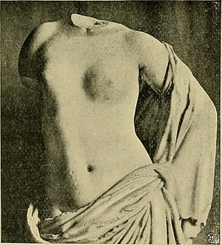 An illustration from Die Kultur des weiblichen Körpers als Grundlage der Frauenkleidung, 1902, leaf 52