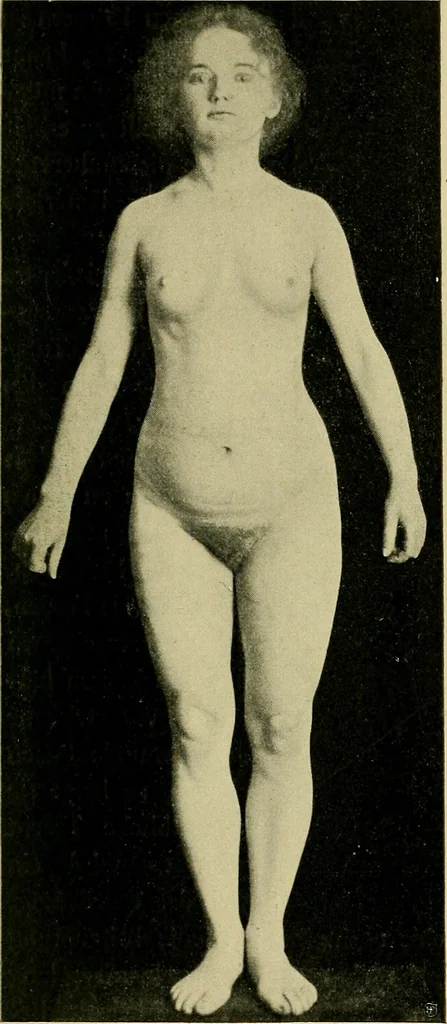 An illustration from Die Kultur des weiblichen Körpers als Grundlage der Frauenkleidung, 1902, leaf 78