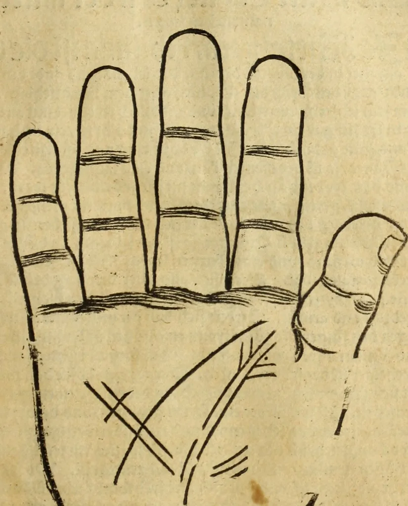 An illustration from Die Kunst der Chiromantzey : vsz Besehung der Hend. Physiognomey / vsz Anblick des Menschens. Natürlichen Astrologey noch dem Lauff der Soñen. Complexion eins yegklichen Menschens. Natürlichen Ynflüssz der Planeten. der zwolff Zeichen Angesychten. Ettliche Canones / zu Erkantnüsz der Menschen Kranckheiten / solicher weisz vormals nye beschriben oder gedruckt. Zusamen verordnet / vnd verteütscht durch ..., 1523, leaf 22