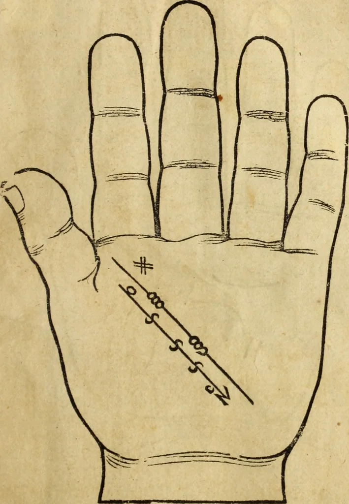 An illustration from Die Kunst der Chiromantzey : vsz Besehung der Hend. Physiognomey / vsz Anblick des Menschens. Natürlichen Astrologey noch dem Lauff der Soñen. Complexion eins yegklichen Menschens. Natürlichen Ynflüssz der Planeten. der zwolff Zeichen Angesychten. Ettliche Canones / zu Erkantnüsz der Menschen Kranckheiten / solicher weisz vormals nye beschriben oder gedruckt. Zusamen verordnet / vnd verteütscht durch ..., 1523, leaf 26