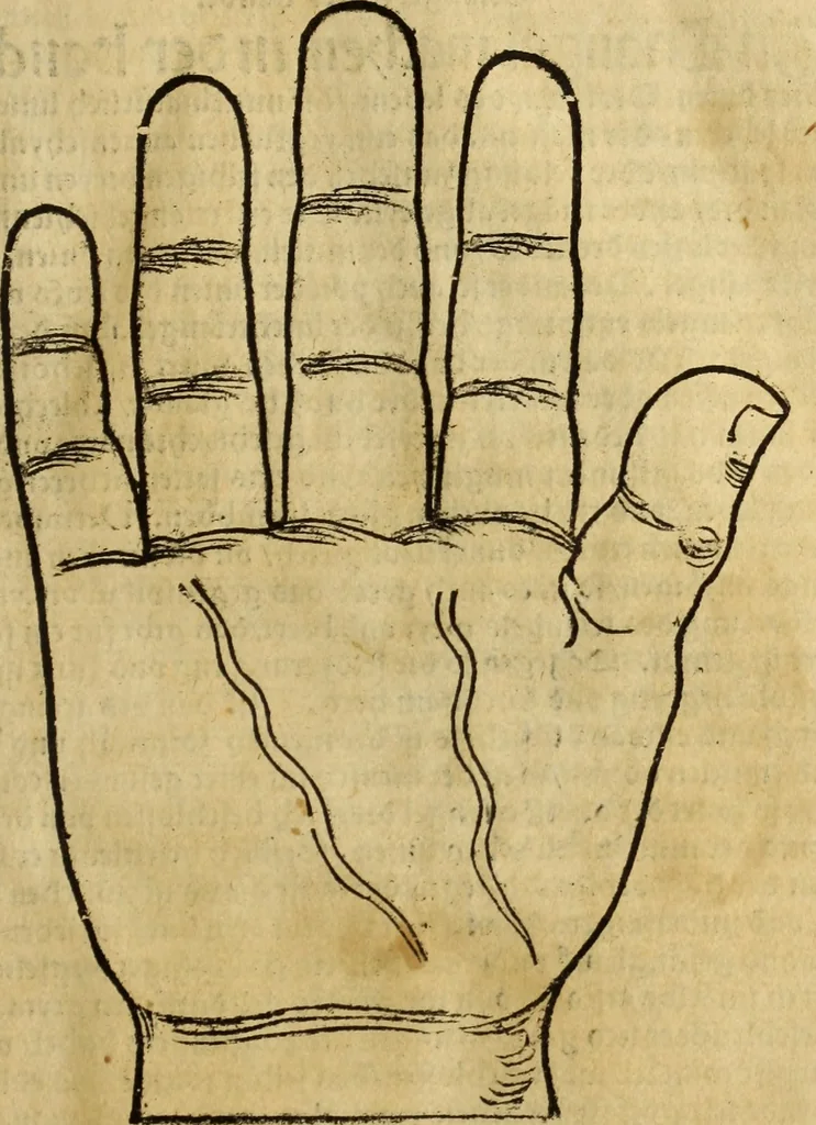 An illustration from Die Kunst der Chiromantzey : vsz Besehung der Hend. Physiognomey / vsz Anblick des Menschens. Natürlichen Astrologey noch dem Lauff der Soñen. Complexion eins yegklichen Menschens. Natürlichen Ynflüssz der Planeten. der zwolff Zeichen Angesychten. Ettliche Canones / zu Erkantnüsz der Menschen Kranckheiten / solicher weisz vormals nye beschriben oder gedruckt. Zusamen verordnet / vnd verteütscht durch ..., 1523, leaf 40