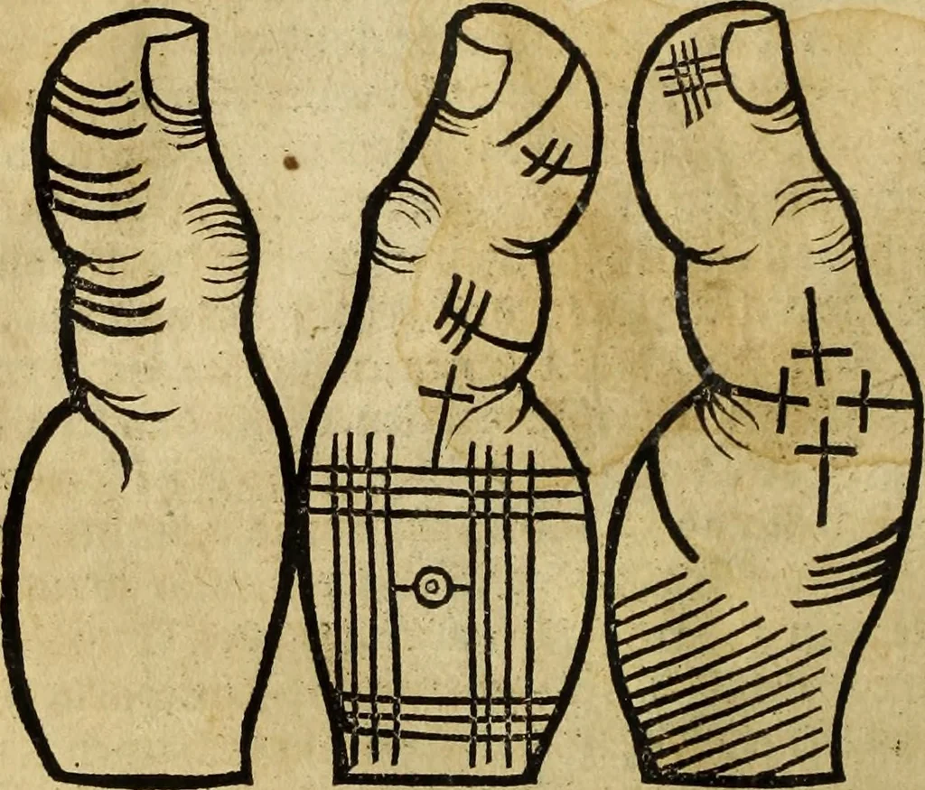 An illustration from Die Kunst der Chiromantzey : vsz Besehung der Hend. Physiognomey / vsz Anblick des Menschens. Natürlichen Astrologey noch dem Lauff der Soñen. Complexion eins yegklichen Menschens. Natürlichen Ynflüssz der Planeten. der zwolff Zeichen Angesychten. Ettliche Canones / zu Erkantnüsz der Menschen Kranckheiten / solicher weisz vormals nye beschriben oder gedruckt. Zusamen verordnet / vnd verteütscht durch ..., 1523, leaf 49
