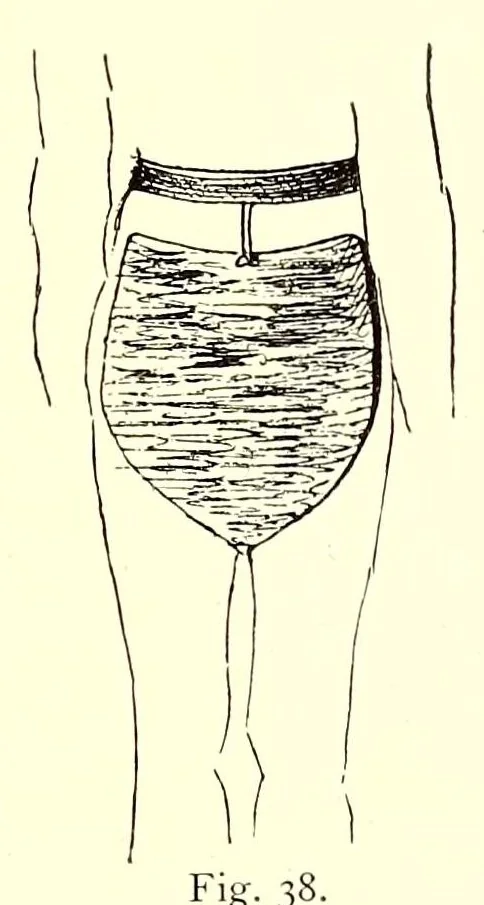 An illustration from Die Masai. Ethnographische Monographie eines ostafrikanischen Semitenvolkes, 1910, leaf 177