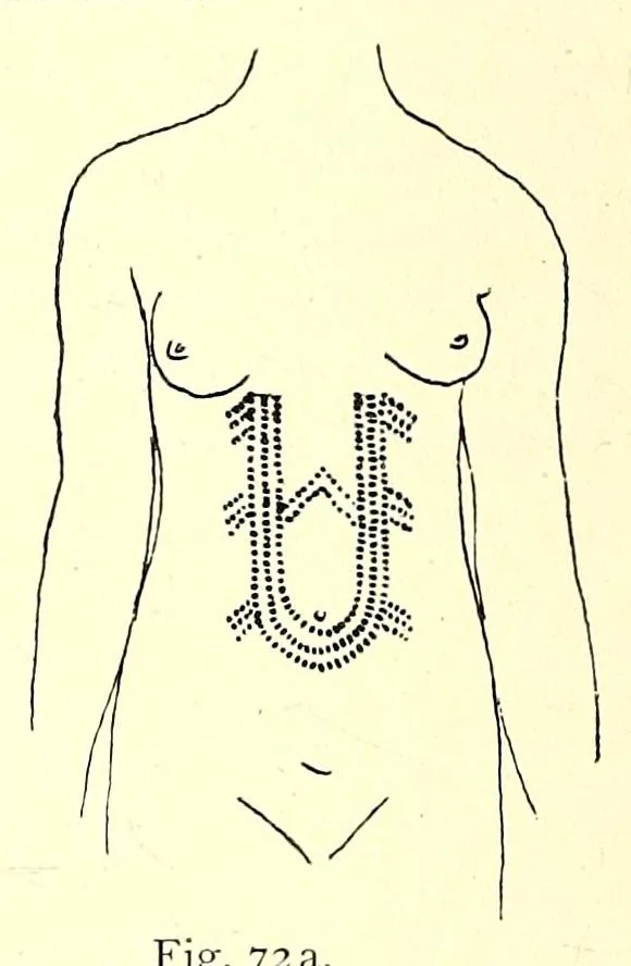 An illustration from Die Masai. Ethnographische Monographie eines ostafrikanischen Semitenvolkes, 1910, leaf 192