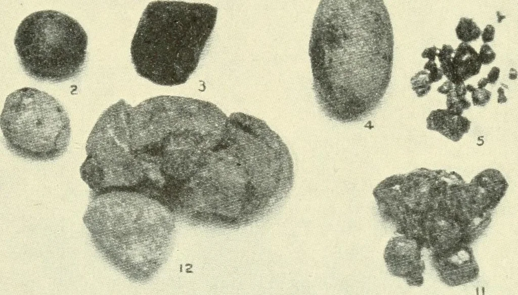 An illustration from Die Röntgenstrahlen im Dienste der Chirurgie, 1902, leaf 86