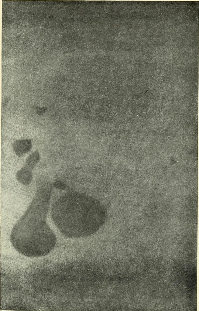 An illustration from Die Röntgenstrahlen im Dienste der Chirurgie, 1902, leaf 92
