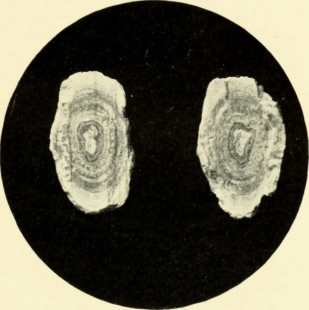 An illustration from Die Röntgenstrahlen im Dienste der Chirurgie, 1902, leaf 98
