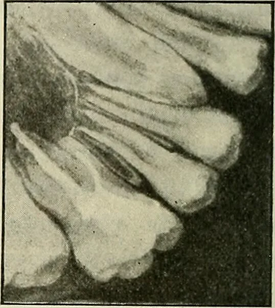 An illustration from Die Röntgentechnik : Lehrbuch für Ärzte und Studierende, 1906, leaf 217