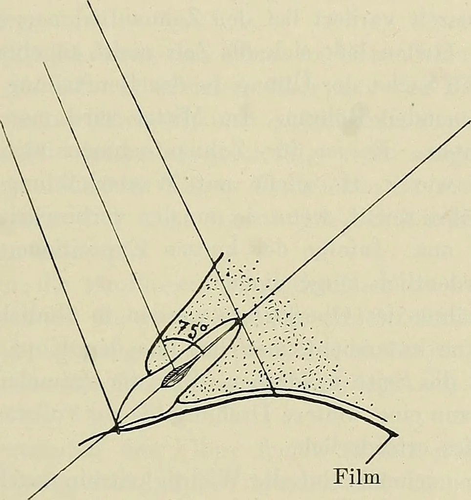 An illustration from Die Röntgentechnik : Lehrbuch für Ärzte und Studierende, 1906, leaf 220
